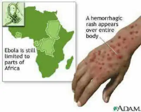 Two Year Old Baby Identified As ‘Patient Zero’ Of Ebola Virus